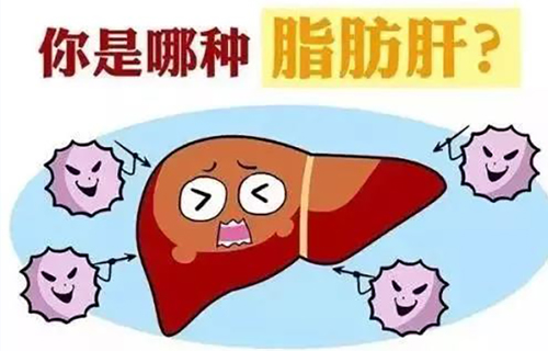 體檢發(fā)現(xiàn)脂肪肝怎么辦？輕松應(yīng)對脂肪肝，聽聽肝膽專家是咋說滴！