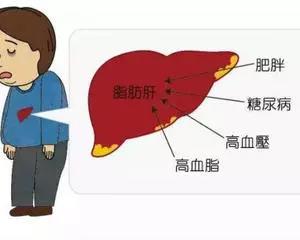 醫(yī)生說我有脂肪肝，是不是少吃幾頓就好了？